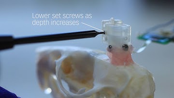 oDrive: Chronic Optogenetics Microdrive