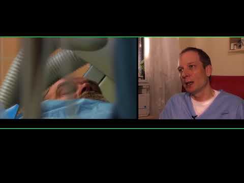 Video: Fluoresceínová Angiografia: Účel, Postup A Výsledky