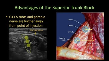 Advantages of the SUPERIOR TRUNK BLOCK