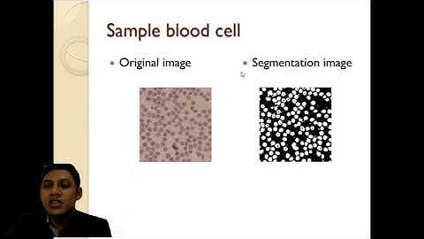 Size-based Feature Extraction on Blood CellsCalculation Process Using k-Means Clustering