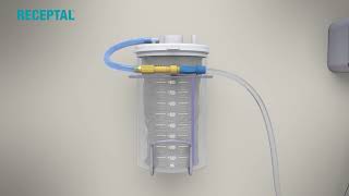 RECEPTAL® Single Canister Installation