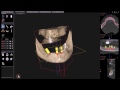 Computed tomography. Dental implantation. Implantology clinic &quot;Papadent&quot; in Vilnius.