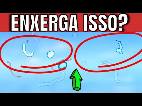 Vídeo: 3 maneiras de se livrar dos olhos flutuantes