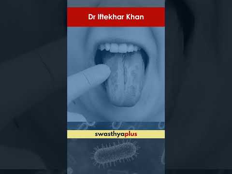 فنگل انفیکشن کی علامات کیا ہیں؟ | Symptoms of Fungal Infection | Dr Iftekhar Khan | #Shorts