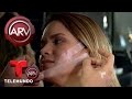 Insólita técnica de belleza con cinta adhesiva | Al Rojo Vivo | Telemundo