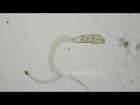 Cercaria(swimmer's itch cause)/ Церкария, вызывающая зуд купальщика