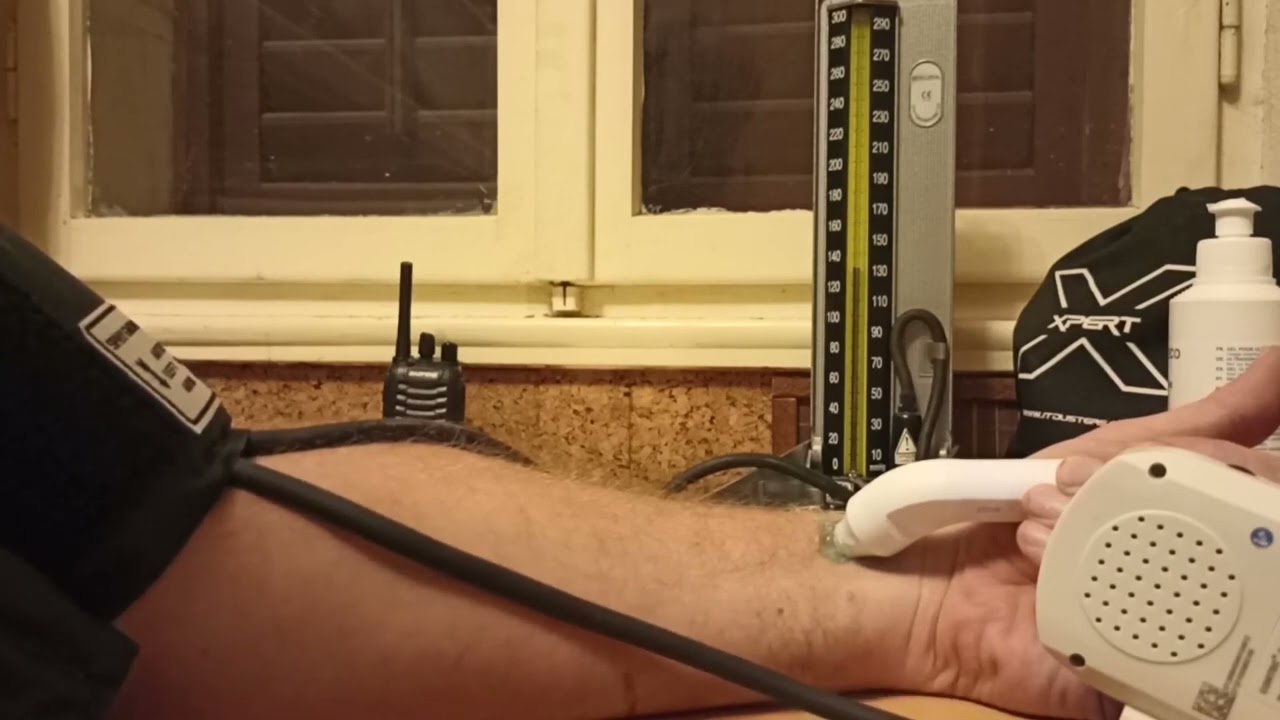 Old Mercury Sphygmomanometer & Modern Vascular Doppler Probe Systolic Blood Pressure