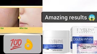 Eveline Whitening Cream/ Spf 20/ It really works/ #Best cream ever/ recommended
