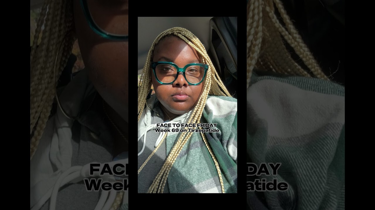 TIRZEPATIDE BEFORE AND AFTER | GLP-1 | PCOS | MOCHI HEALTH