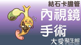 【大愛醫生館】 結石卡膽管 20260821