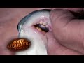 This Fish Has HUMAN TEETH! | BOGA | River Monsters