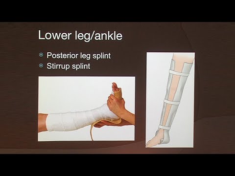 broken bones iv Splinting and Evacuation