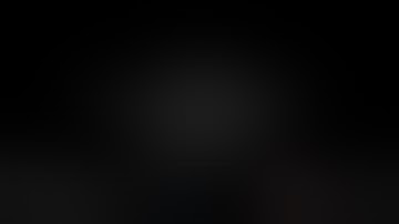 Robot-Assisted Pyeloplasty with Pyelolithotomy