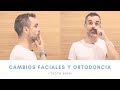 TOOTH BOSS || ¿La ORTODONCIA puede cambiarme la CARA? 😱|| Ortodoncia en Murcia