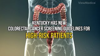 Kentucky has new colorectal cancer screening guidelines for high-risk patients