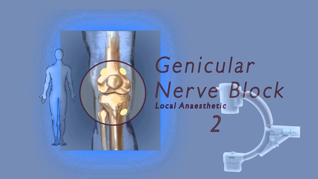 C mo Utilizar Pila De Alquiler Genicular Knee Block Diente Tos Para Llevar c-mo-utilizar-pila-de-alquiler-genicular-knee-block-diente-tos-para-llevar