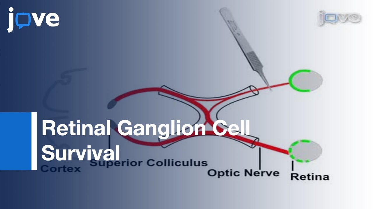 Optic Nerve Crush Injury Murine Model To Study Retinal Ganglion Cell