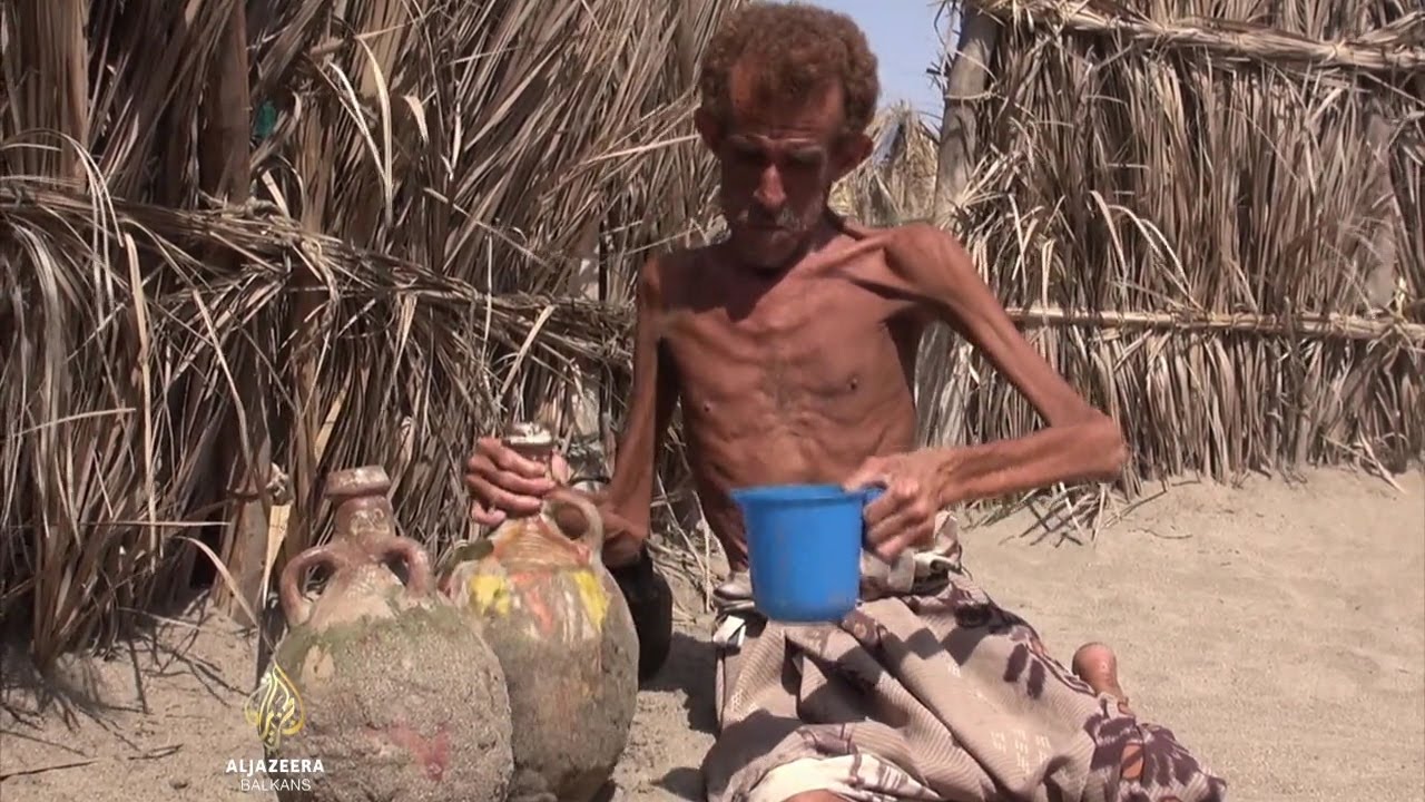 Резултат слика за glad u 'zaboravljenom' Jemenu