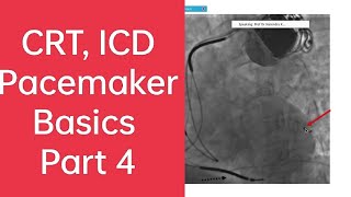 #CRT introduction and its indication #ICD  #resynchronisation #therapy #drnarendrakumar #crtd