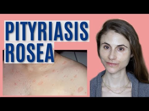PITYRIASIS ROSEA: WHAT IT IS & GETTING RID OF IT| DR DRAY
