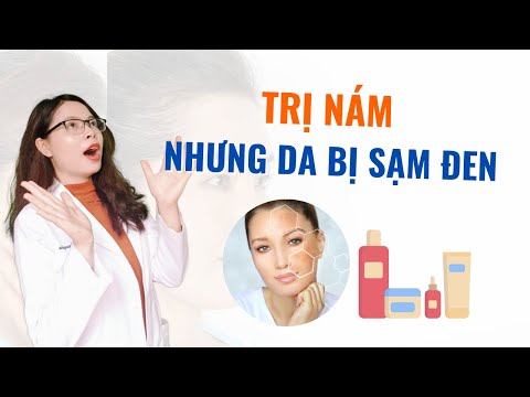 Da Bị Sạm Màu - Trị nám mà da bị sạm đen thì cần biết 4 điều này - Bác sĩ Nguyên