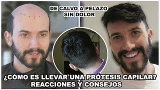 De CALVO a PELAZO ¿CÓMO es LLEVAR una PRÓTESIS CAPILAR? EXPERIENCIA, REACCIONES y CONSEJOS