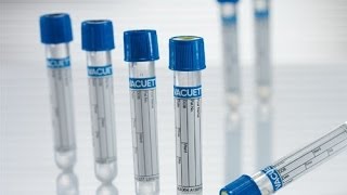 blood collection tube labeling machine small round container label equipment Rohr-Etikettiermaschine screenshot 4