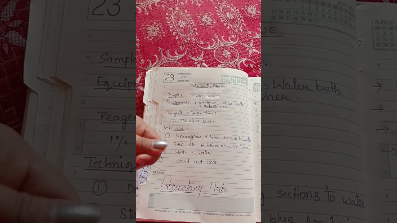 what is the use of Toluidine Blue staining ?