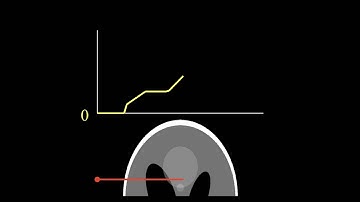 Linear X-ray measurement of Shepp-Logan phantom