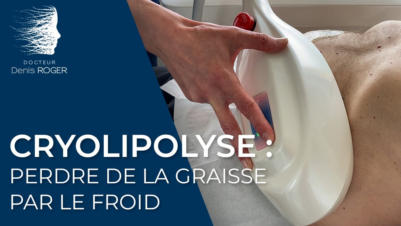 Séances de cryolipolyse avec le Dr Roger à Limoges