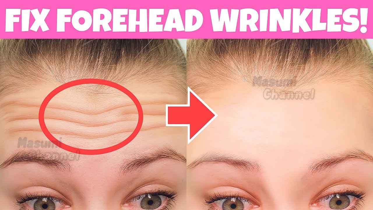 Reduce Forehead Wrinkles In 2 Weeks Forehead Massageand Exercise Get Bigger Eyes Fix Droopy