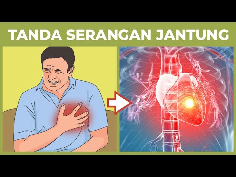 Video: Bisakah terkena serangan jantung?