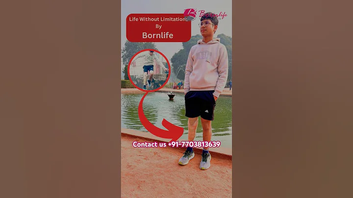 #prostheticlimb #ossur #artificiallimb #lowerlimb #facts #nakli #nakliungli #naklipair #viralvideo