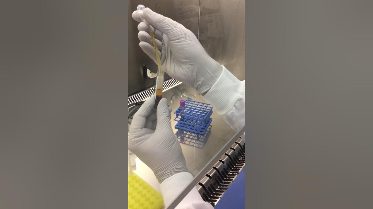 Buffy Coat and plasma separation IBIS 3 YouTube