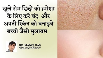 How to Get Rid of Open Pores Permanently I खुले रोम छिद्र कैसे ठीक करें | DR. MANOJ DAS