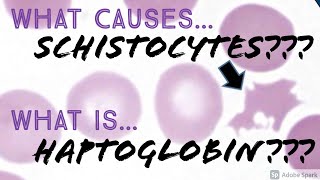 What causes Schistocytes? What is Haptoglobin? Hematology Hematopathology Basics screenshot 4