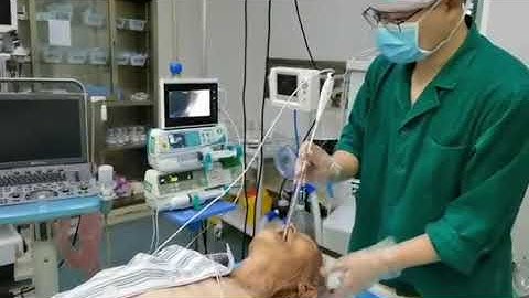 BD-DVS DISPOSABLE VIDEO STYLET intubation in teeth loose patient.