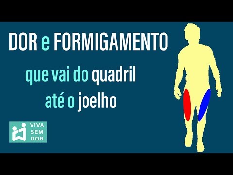 Vídeo: Dormência Da Perna Do Quadril Ao Joelho Do Lado De Fora: Causas E Tratamento