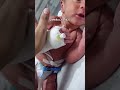 New born baby in NICU #hospital #internationallyeducatednurse #medical #nurse #medicosstuff #nurse