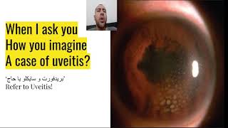 Beginner's guide for Uveitis
