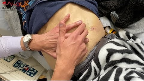 How to Perform Shifting Dullness for Ascites | Technique + Physiology Explained