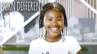 The Girl Born With No Eyes | BORN DIFFERENT