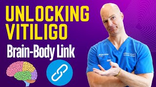 Unlocking Vitiligo. The Surprising Brain-Body Link You Need to Know Wealth