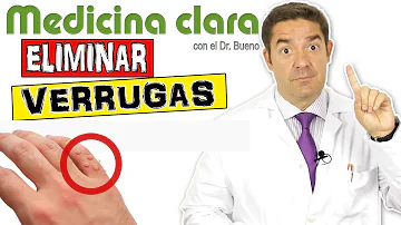 ¿Qué no se puede hacer con una verruga?