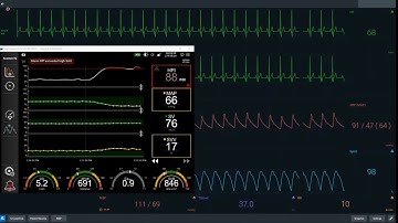 HPI case study 3 - vasopressor therapy