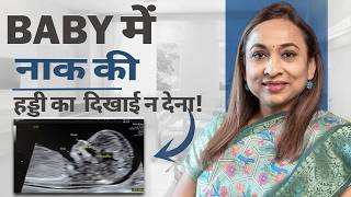 Nasal Bone Missing in Pregnancy Scan What to do if the nasal bone is not visible in the pregnancy... screenshot 1