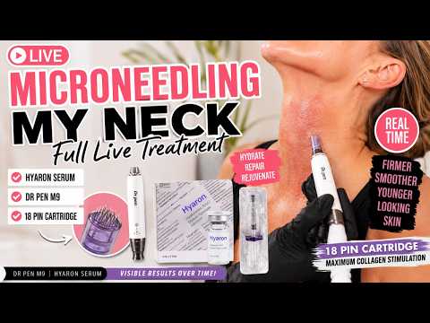 Microneedling My Crepey Neck LIVE 💉 Dr Pen M9 + Hyaron Treatment