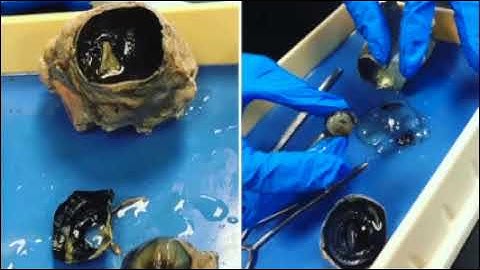 Project Lead the Way  - Biomedical