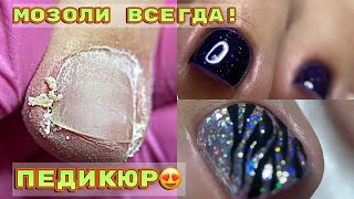 Педикюр 💅 Вычищаем постоянные подногтевые мозоли 💅 Тигровый дизайн ногтей