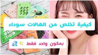 كيف تخلص من الهالات سوداء ? بمكون واحد فقط ✨?